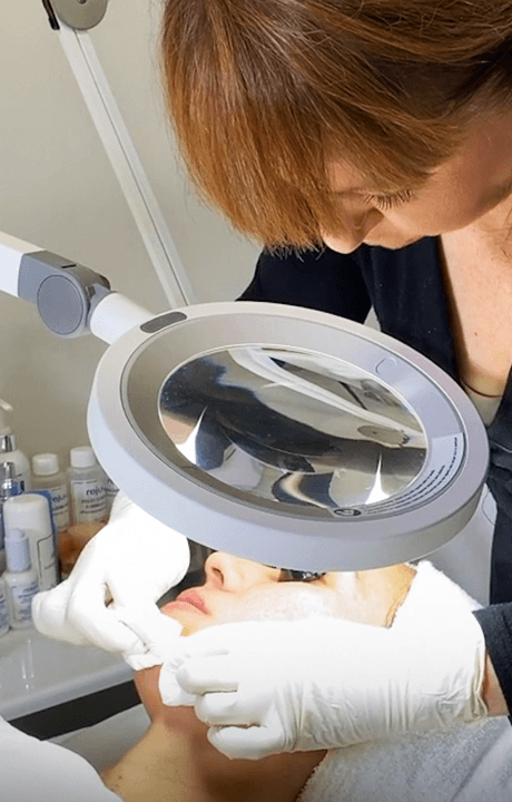 Webinar_Acne Scarring_Mobile