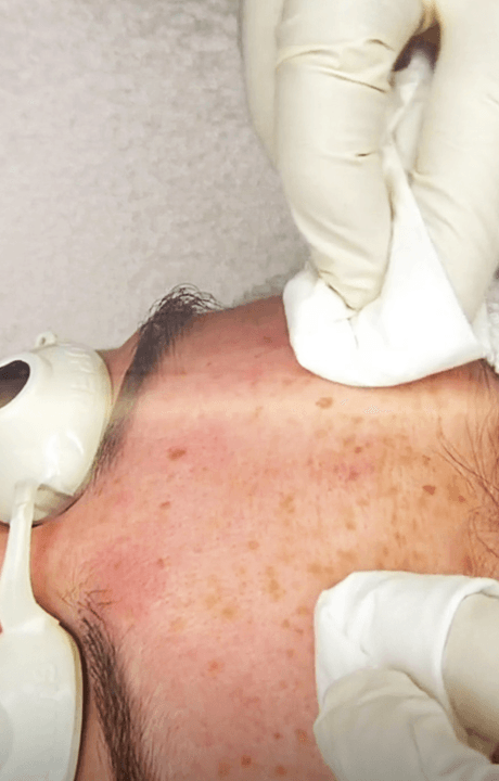 Webinar_Extractions_Mobile